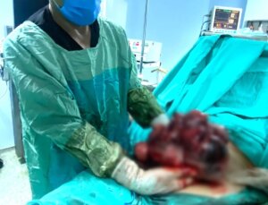 20 Yıldır Çocuk Sahibi Olma Hayali Kuran Bayanın Karnından 10 Kilo Kitle Çıkarıldı