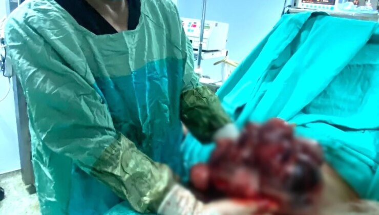 20 Yıldır Çocuk Sahibi Olma Hayali Kuran Bayanın Karnından 10 Kilo Kitle Çıkarıldı