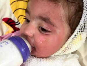 Adana’da Anaokulunda Yangın Riski: 1.5 Yaşındaki Kız Çocuğu Yaralandı